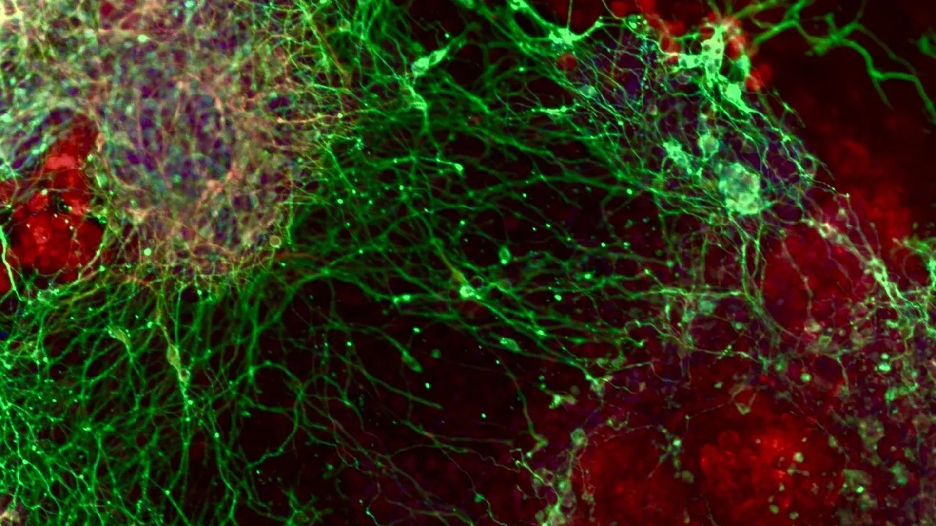 Uma busca massiva por genes revela como as células cerebrais são feitas.